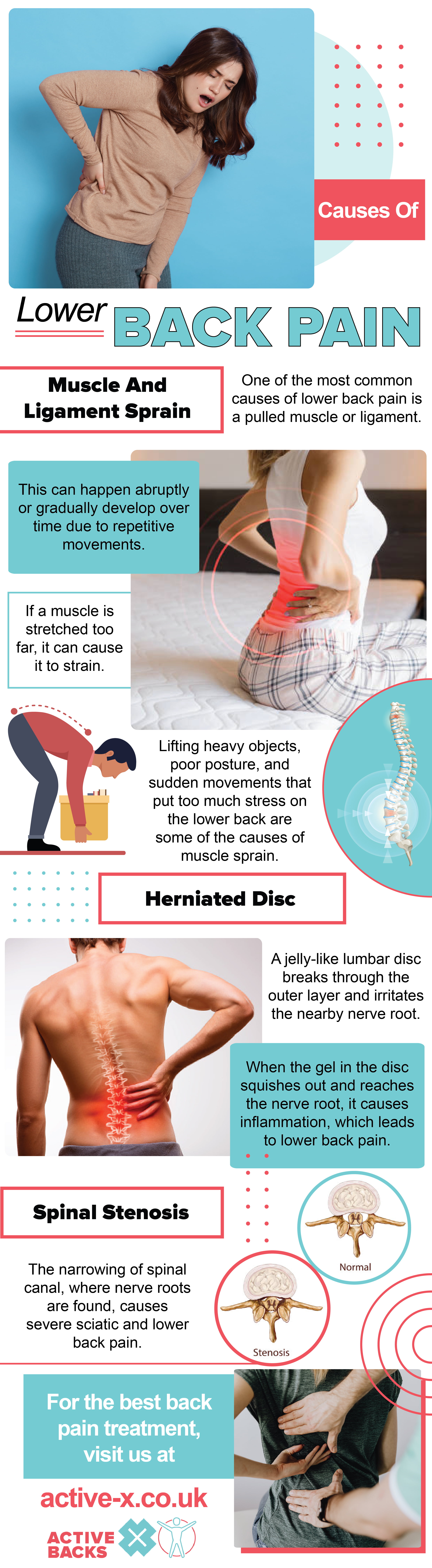 Causes of lower back pain